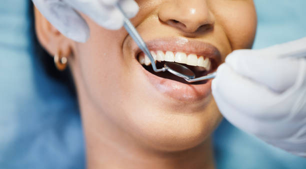Best Emergency Root Canal Treatment in Pflugerville, TX